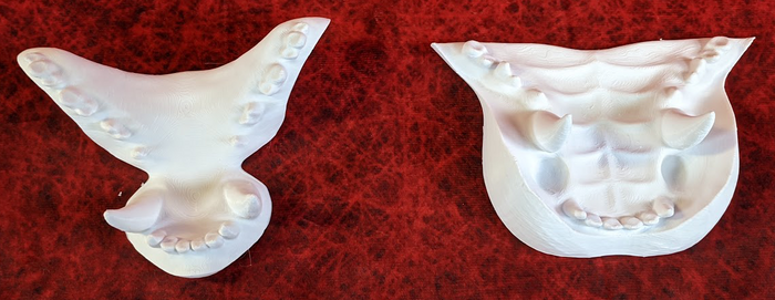 Large Jawset Top and Bottom Upcharge